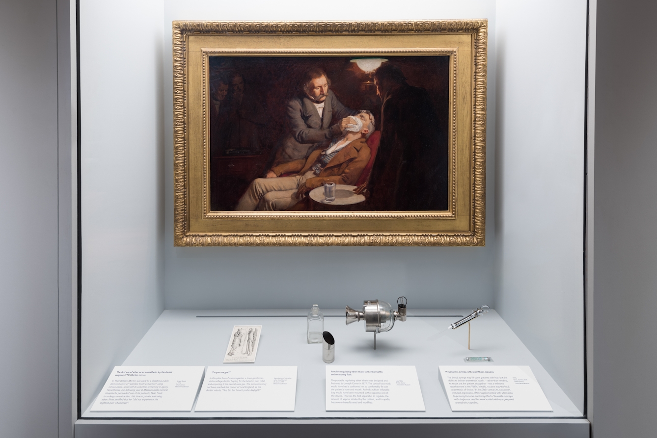 Photograph of an oil painting on display in the Teeth exhibition at Wellcome collection. The oil painting shows a dentist anaesthetising a patient by placing a cloth soaked in ether over his mouth.