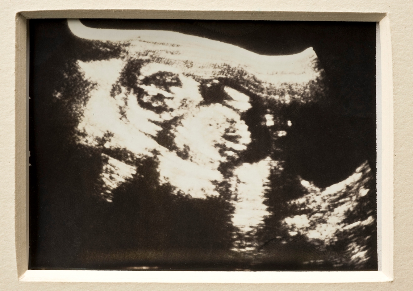 Polaroid of ultrasound scan, London, England, 1981