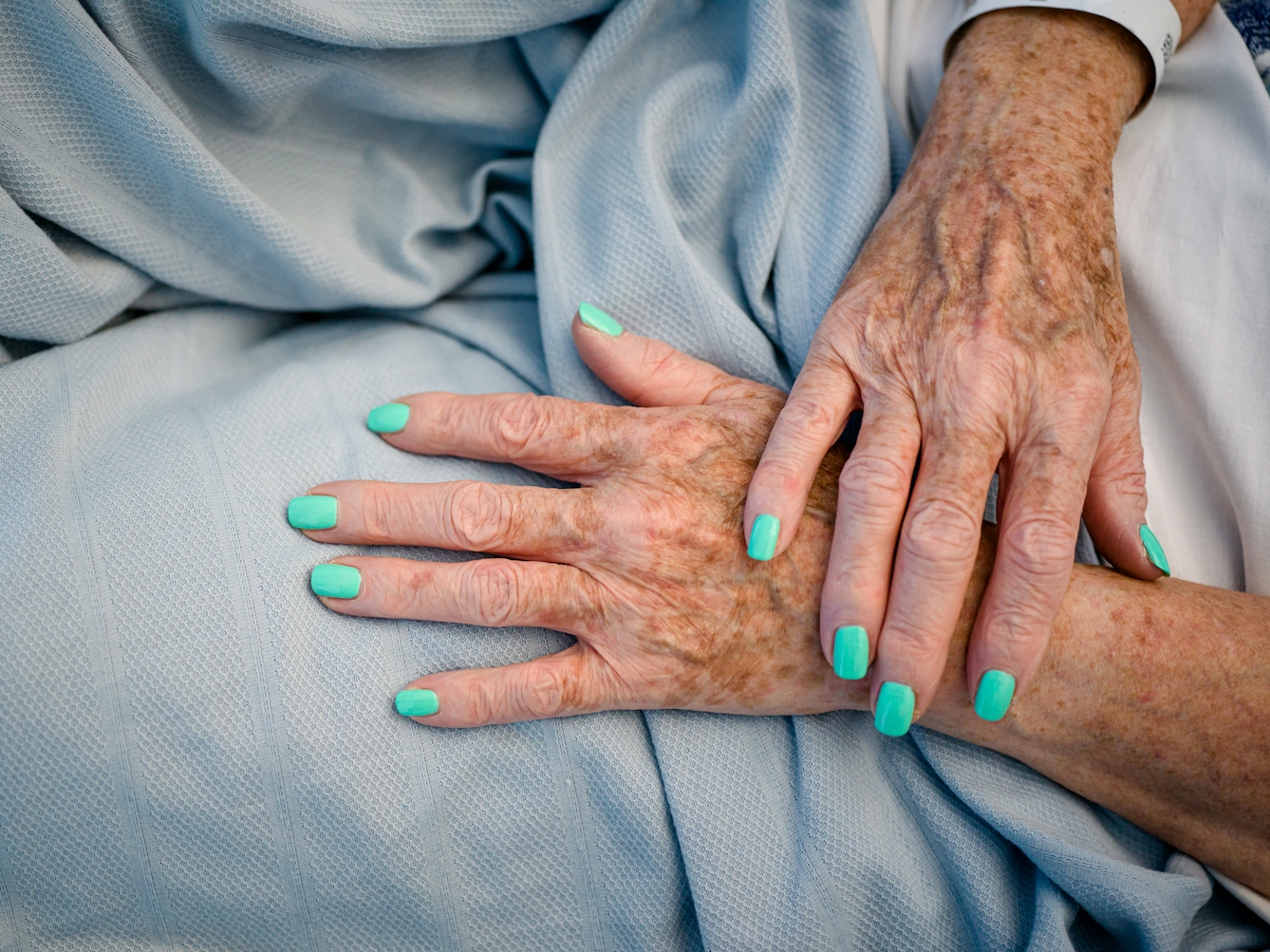 Photograph of the hands of a patient with bright turquoise painted fingernails, resting on a light blue hospital bedsheet. 