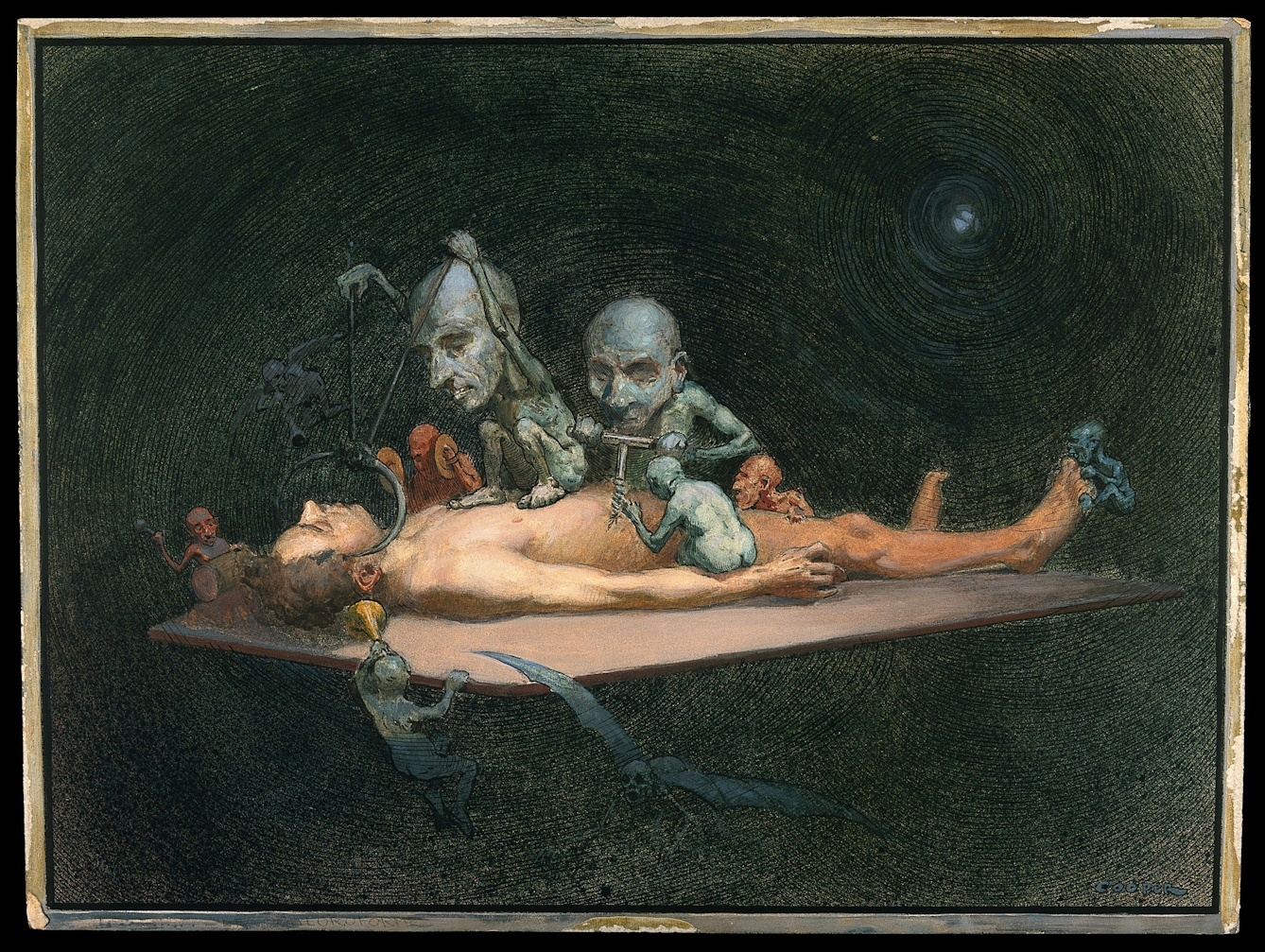 Watercolour painting showing an unconscious naked man lying on a table being attacked by little demons armed with surgical instruments