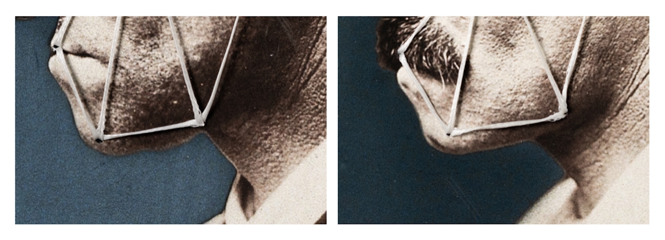 An image of close ups crops of two photographs of a man in profile showing the man's jawline and mouth pre and post plastic surgery. The photographs have been altered with thread so that a series of triangles mimic his facial features with vector like patterns. 
