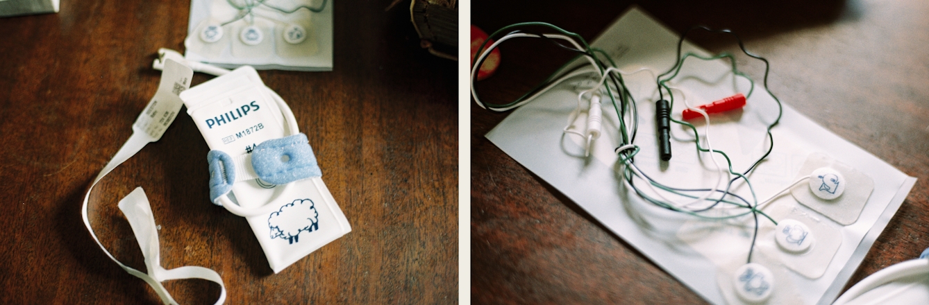 Photographic diptych. The image on the left shows a baby's hospital wrist band and monitoring band resting on a dark wooden tabletop. The large tag has a line drawing of a sheep on it with a small padded cuff. The image on the right shows a white rectangle of paper, also resting on a dark wooden tabletop. On the paper are the wires and pads from a baby ECG monitoring equipment. On the pads are small line drawings of animals.