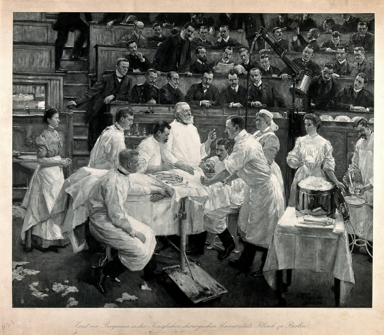 Photogravure of surgeon Ernst von Bergmann operating in an amphitheatre. The artist shows the instruments on a tray ready for use. On the right-hand side a Schimmelbusch drum takes a prominent place. Everybody involved in the operation wears white surgical gowns, which creates a contrast to the dark tones of the background. There are no surgical gloves shown, nor are masks or hats worn in this image. The scene is set in a semi-public operating theatre. The operation takes place in front of an audience of interested colleagues in street clothes. 
