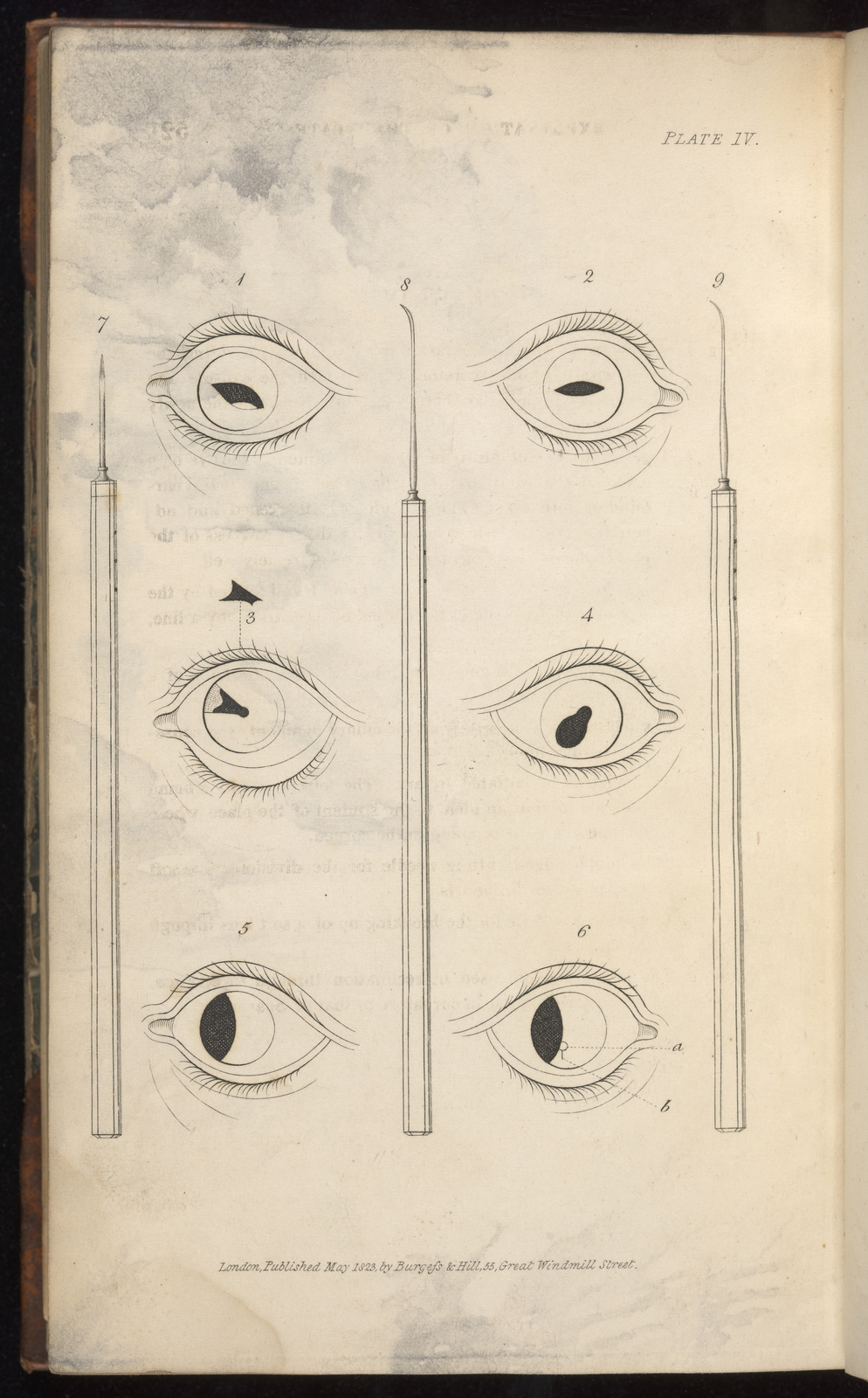Black and white engraving of eyes illustrating how to make incisions of different types.