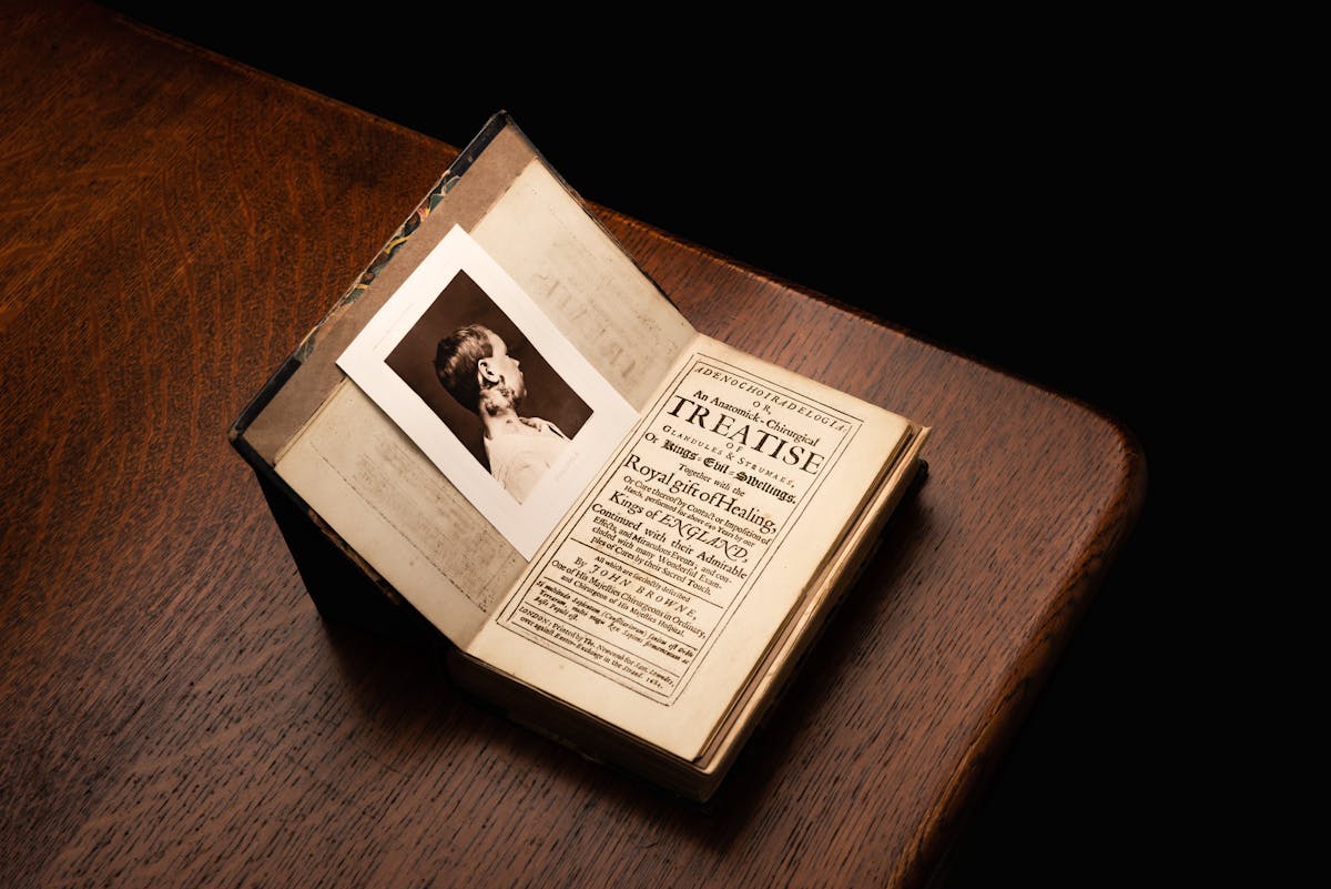 A photograph of a printed book positioned on the corner of a dark wooden table. The book is open at the title page, which reads in part Treatise of Glandules and Strumaes or Kings Evil Swellings. Positioned on the opposite page is photograph of a young boy viewed in profile, running up his neck to below his right ear are darkened swellings.