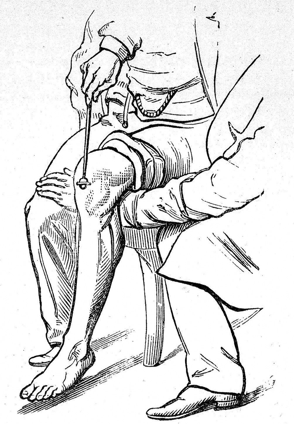 Black and white line drawing of a doctor using a stick to tap a knee of a seated person to test their reflexes.
