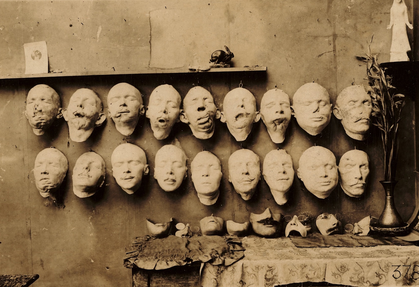 A wall on which are mounted 18 plaster casts of injured faces.