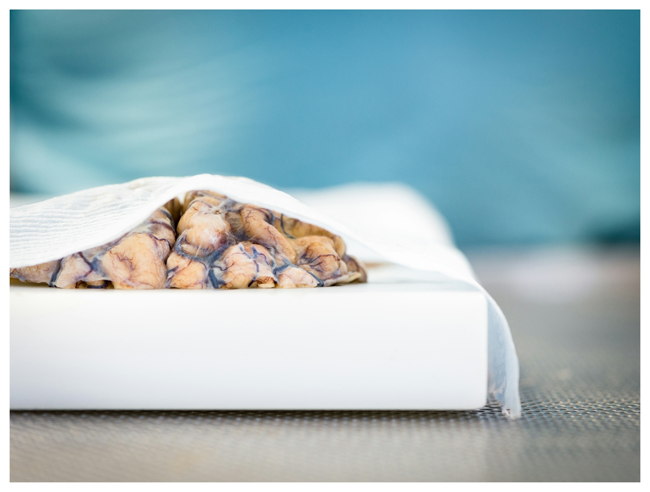 Photograph with a shallow focus of a sliced section of human brain lying on a white chopping board. The sample is delicately covered by a sheet of tissue paper.