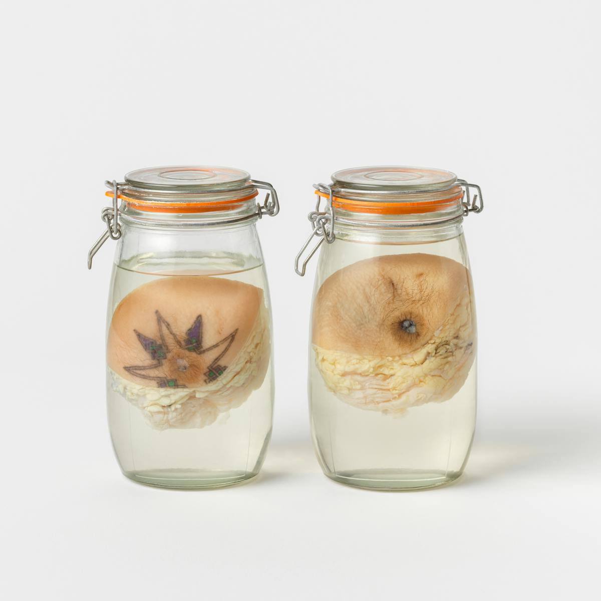 Photograph of 2 Vogue clip top jars containing breast tissue preserved in a liquid. The breast tissue in the jar on the left shows a tattoo around the nipple in a star shape. The breast tissue in the jar on the right show hair around the nipple.