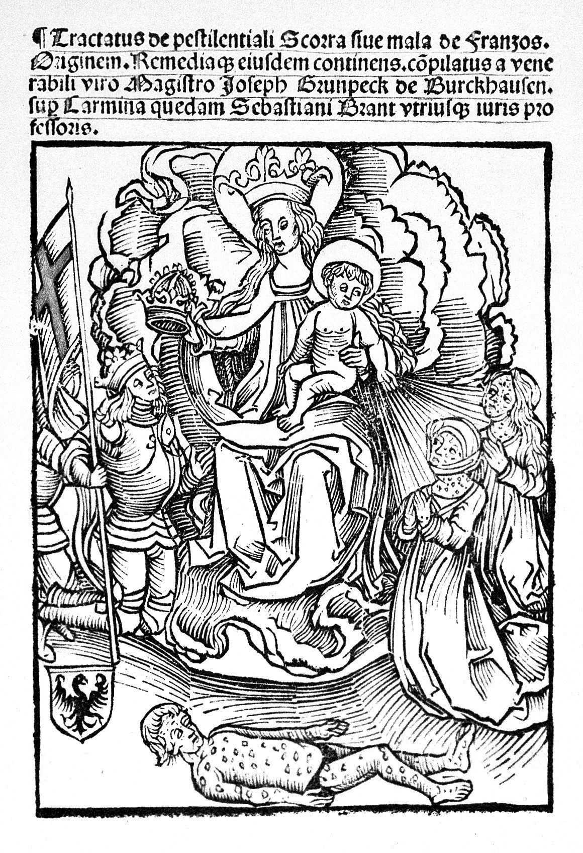 Syphilis woodcut 1496