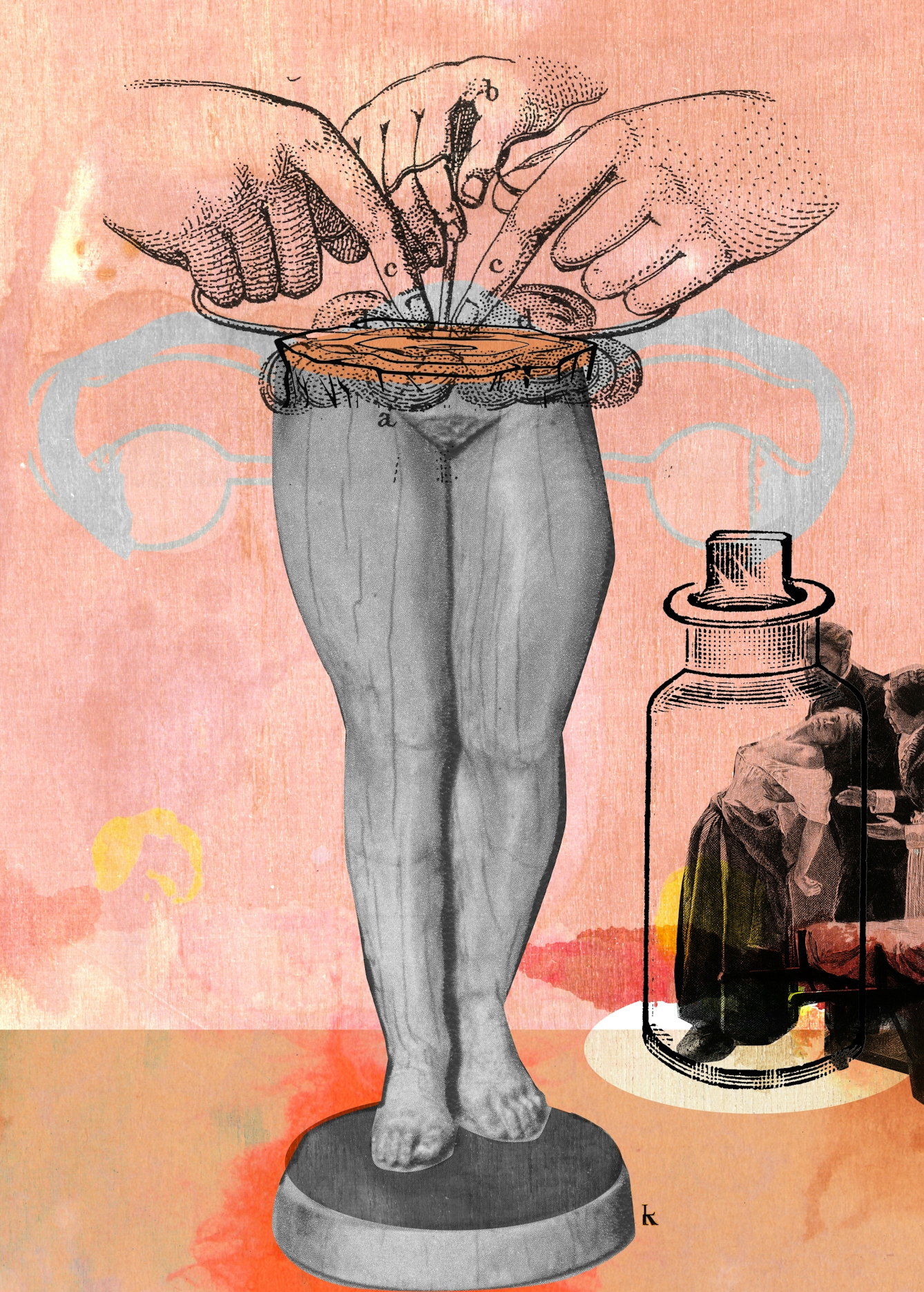 Mixed media digital collage on a pink textured fabric and watercolour background.  In the centre of the image is the  bottom half of a black and white female statue that has been sliced at the midriff with two curved shapes that symbolise the Fallopian tubes.  An etching of a set of hands is seen to operate on the cross section.  In the corner to the bottom right, a man and woman are tending to a woman who appears to have fainted.