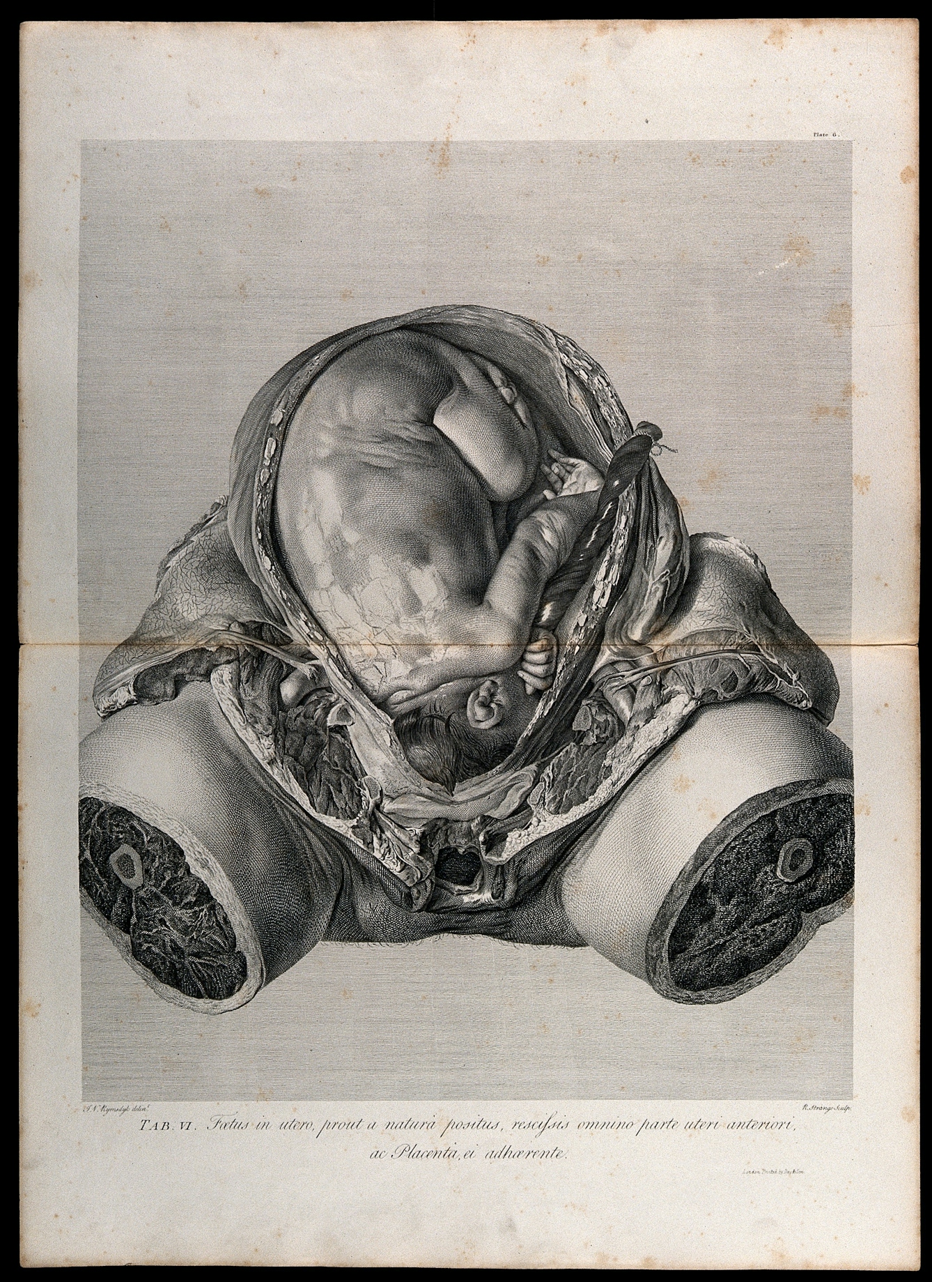 Dissection of the pregnant uterus, showing the foetus at nine months. Copperplate engraving by R. Strange after I.V. Rymsdyk, 1774, reprinted 1851.