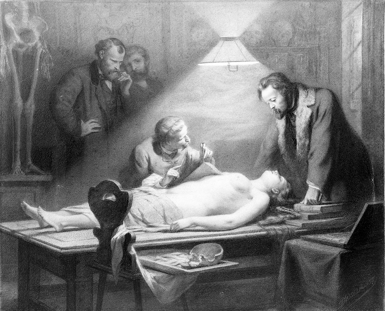 The dissection of a young, beautiful woman directed by J. Ch. G. Lucae (1814-1885) in order to determine the ideal female proportions. Chalk drawing by J. H. Hasselhorst, 1864.