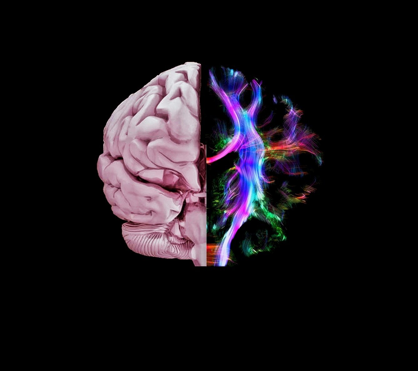 Colour image of brain, one half is pale pink and three-dimensional, the other half is a more abstract swirl of colour lights. Image on black background.