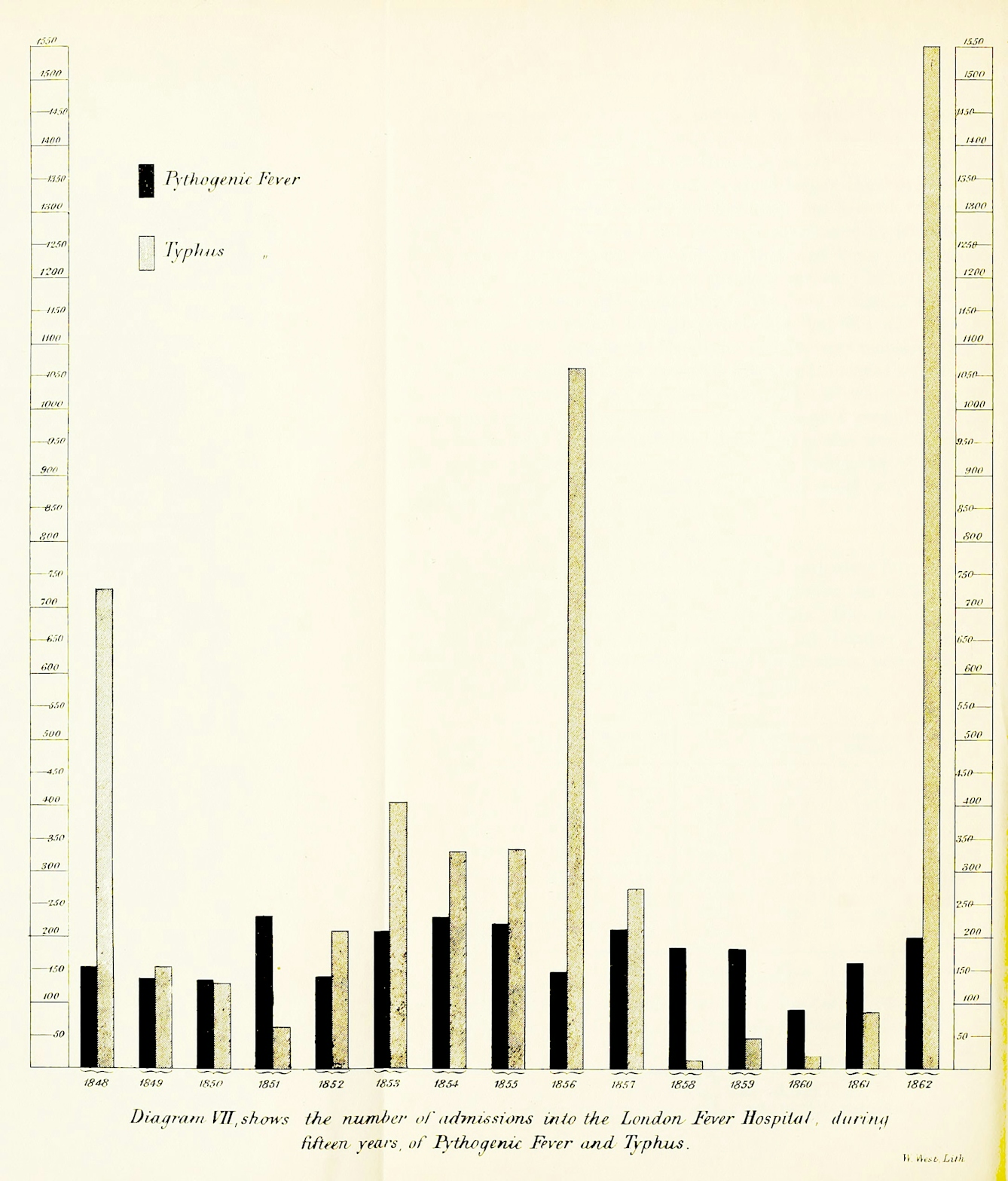 A bar chart showing admissions to the London Fever Hospital over 15 years for Typhus and Typhoid. There are three large spikes fo typus at roughly five year intervals, whereas typhoid incidents of typhoid remain roughly the same over the time period. This suggests that typhus is epidemic, coming in waves but typhoid is endemic, always present in the population and environment.