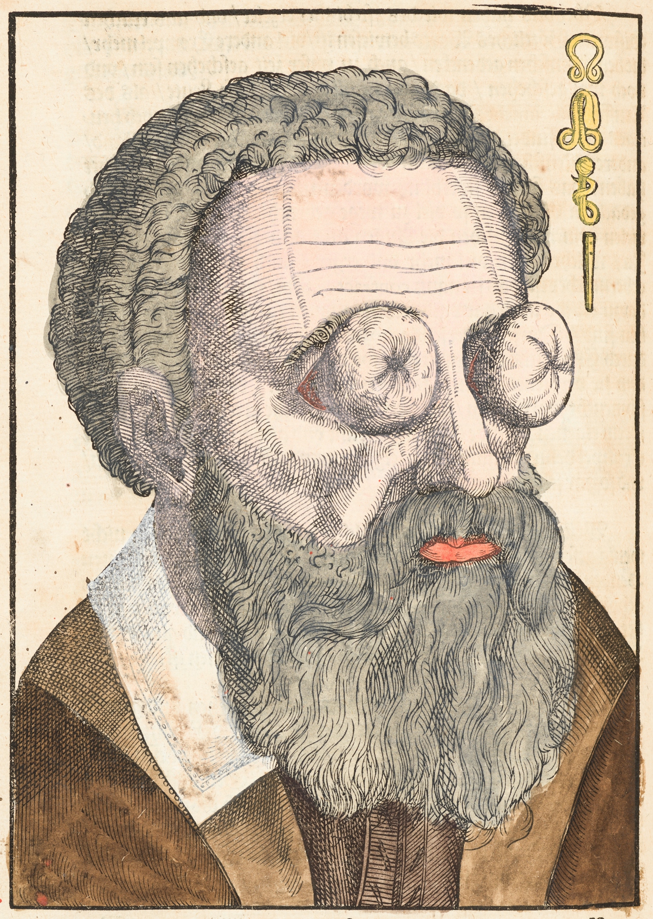 Coloured engraving from a 16th century book showing a bearded man's head and the collar of his clothes. His eyes are covered by two objects which resemble squash-like vegetables.