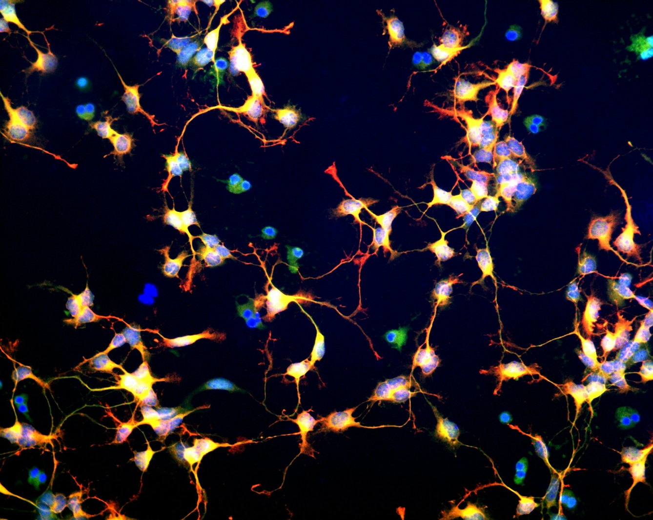 This confocal micrograph shows neuroblasts (neural precursors) beginning to differentiate into neurons. 