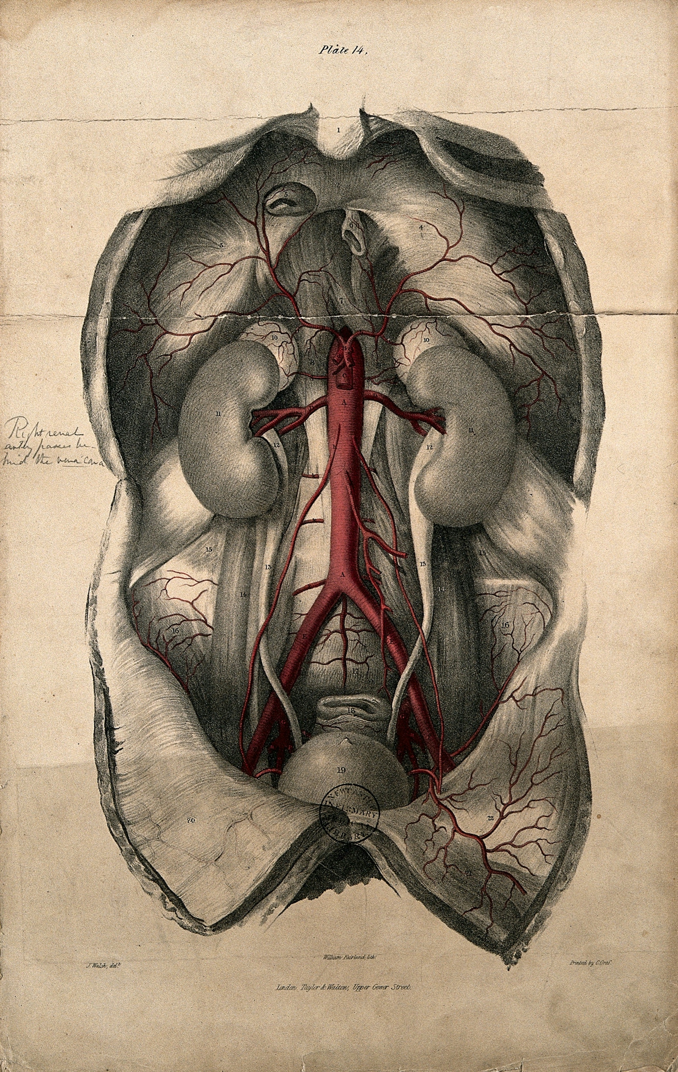 Lithograph showing a cut-open abdomen with the aorta coloured red.