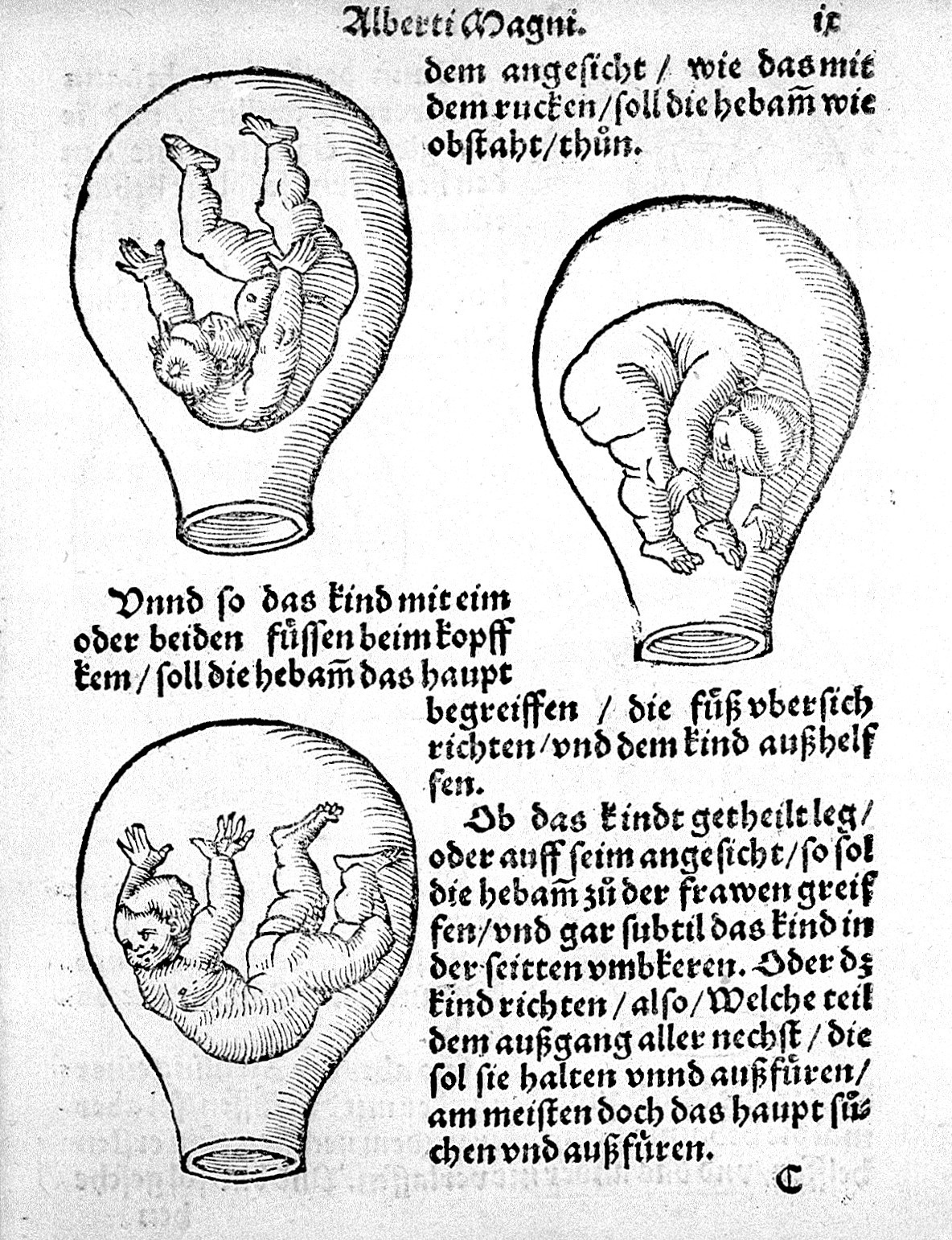 Drawings of foetuses in the womb in varying positions. The womb looks like an alchemical vessel; the foetuses have the features and proportions of an adult. 