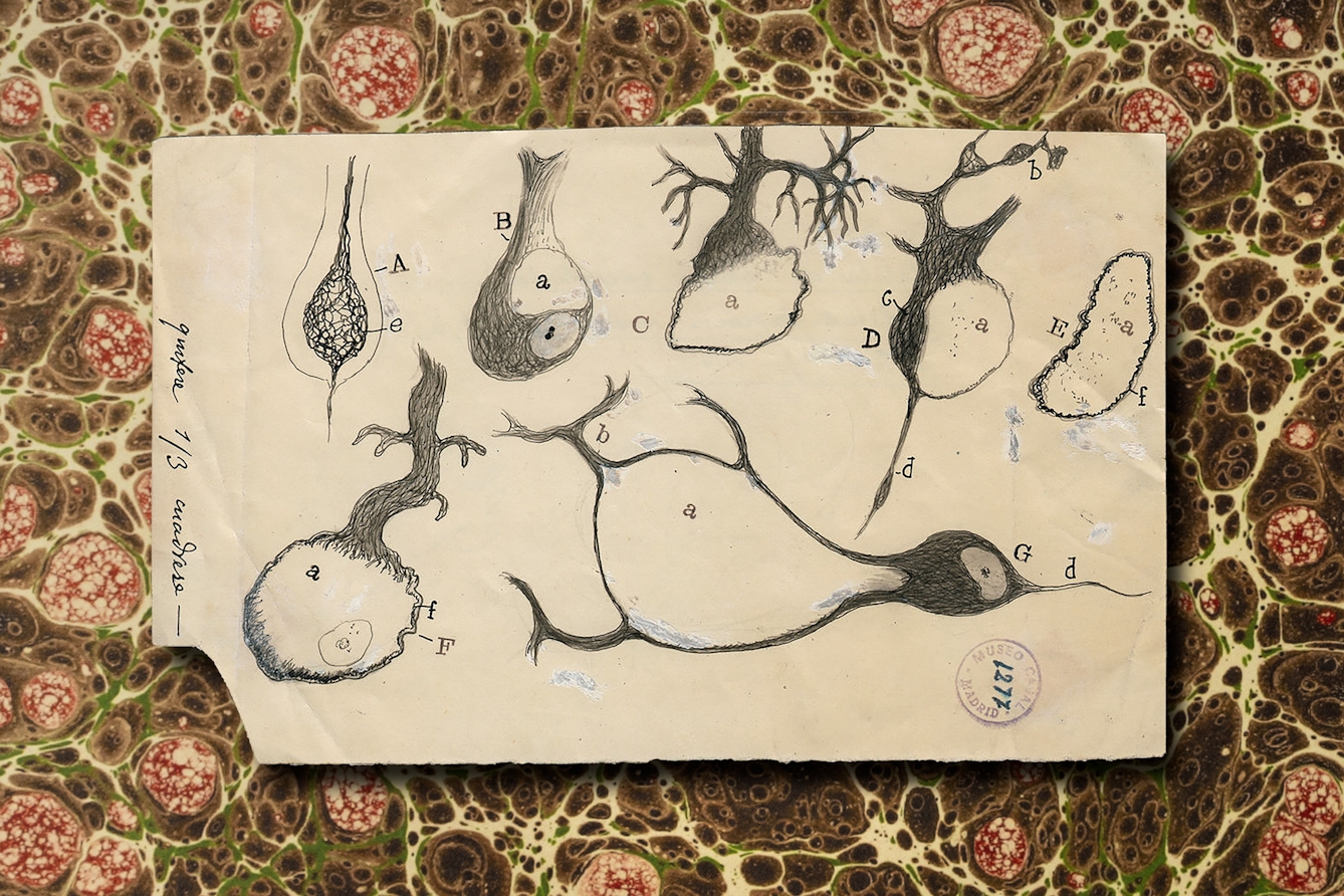 An illustration of neurons of differing sizes and with different numbers of pathways leading off of each one. These are drawn with lines of pencil and black pen. The illustration is against a brown cellular looking marbled background, which has bubbles of red and pathways of yellow and green.