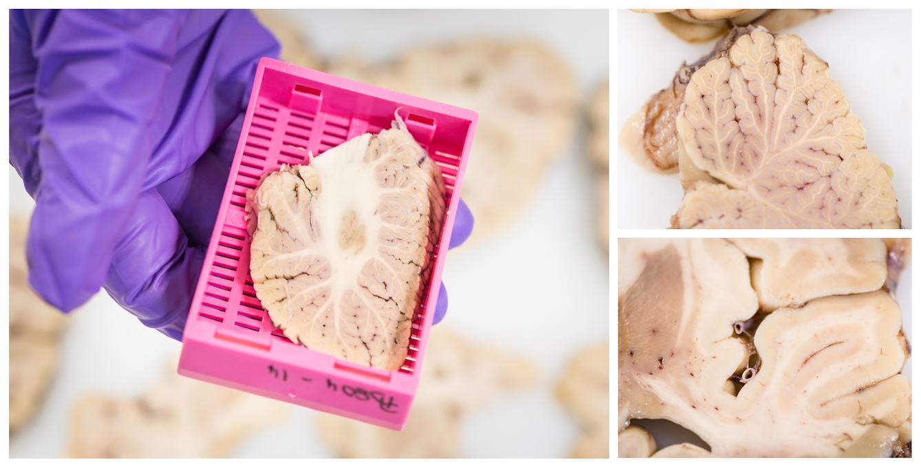 Three photographs clustered together, one large, two small. The large image shows a purple gloved hand holding a pink plastic specimen tray, inside which sits a small sliced section of human brain. The other two images show close-up views of other cross-sections of human brain, detailing the intricate texture and tissue structures.