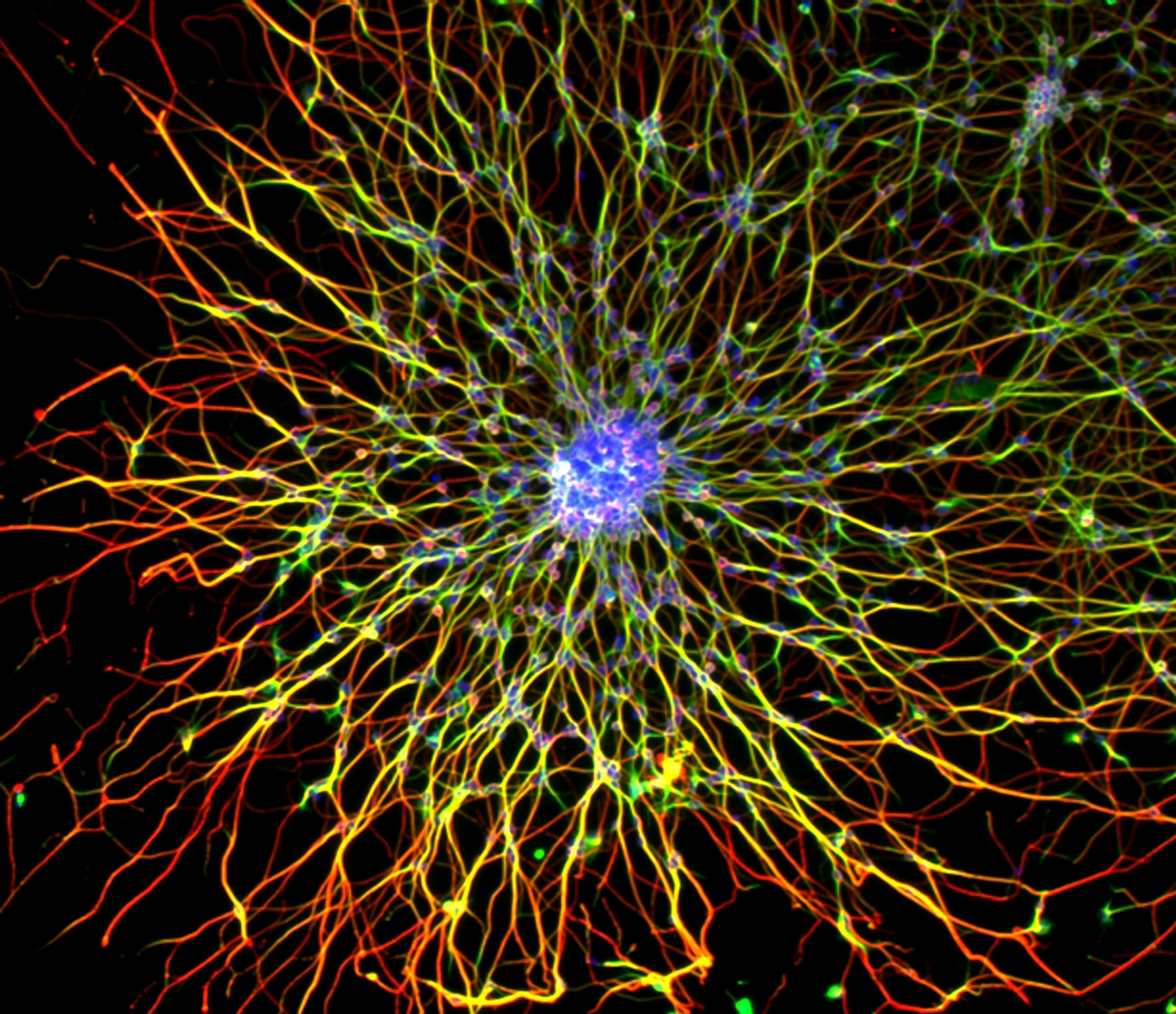 A cluster of cerebellar granule neurons in culture. 