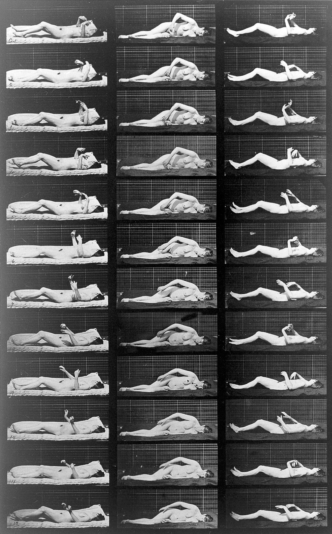 36 sequential photographs of a naked woman having an induced 'convulsion' or seizure