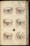 Colour engravings of problems with the eye depicting unusual irises and corneas, for instance with zig-zag lines or clouding.