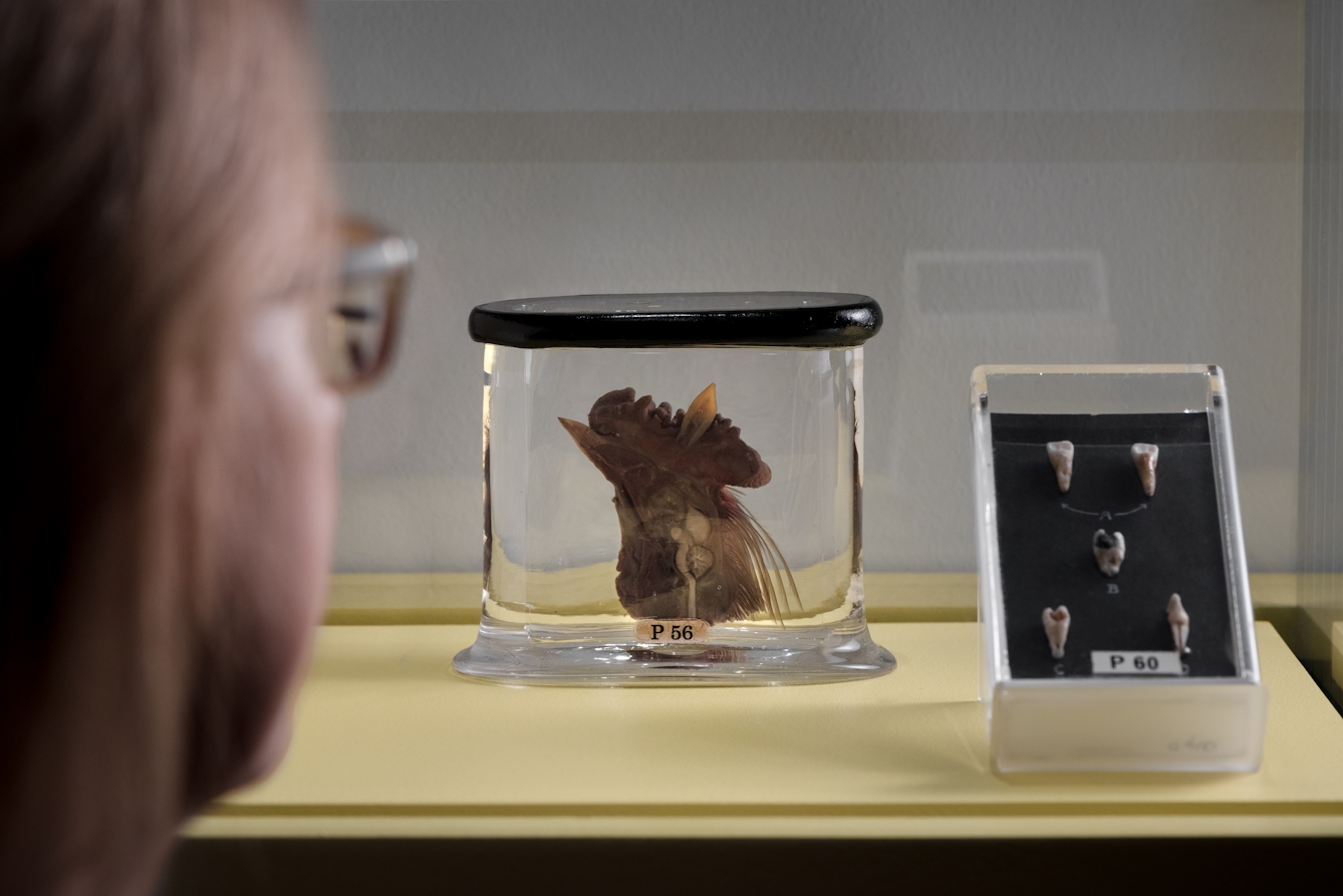 A cockerel's head with a human tooth implanted sits on display in the Teeth exhibition