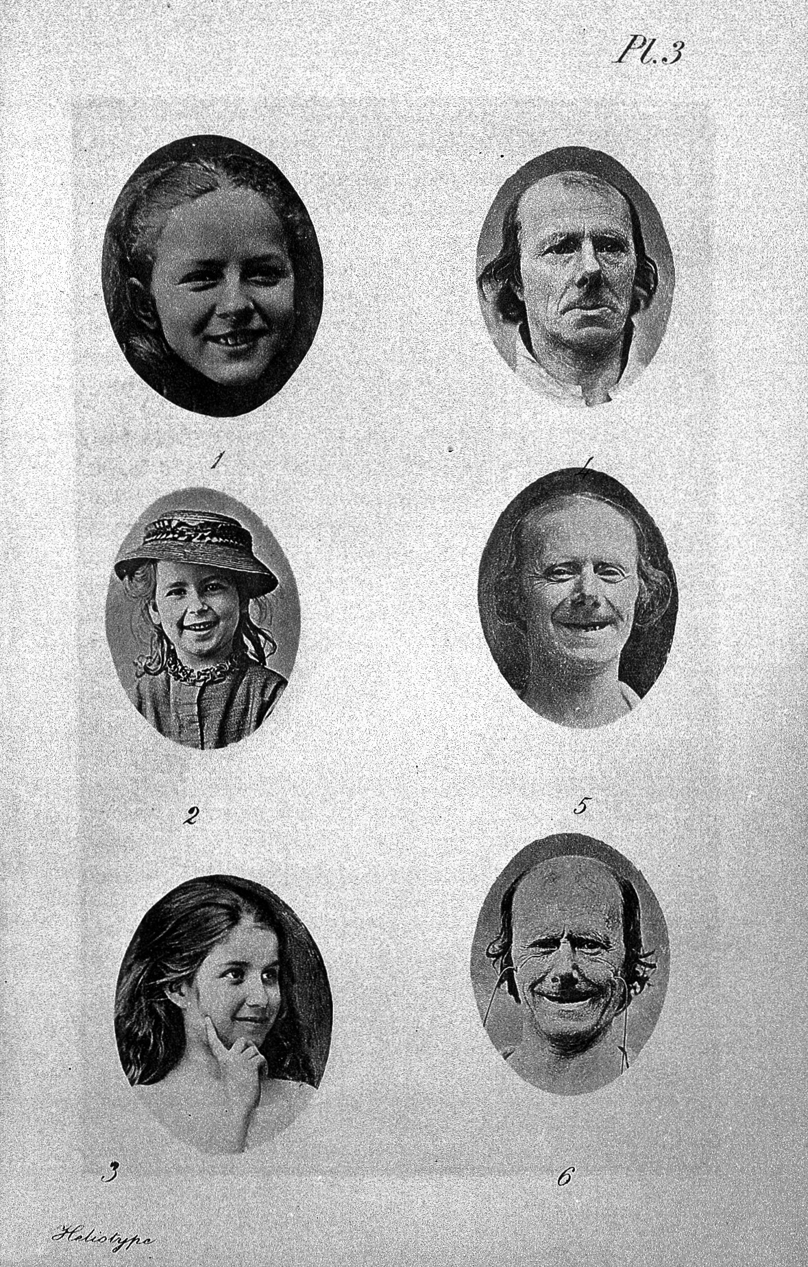 Six ovals on a white background containing images. On the left are three smiling girls. On the right all three pictures depict the same man with a receding hairline and small moustache. He is sombre or sad in the first picture, and grinning in the second and third pictures.