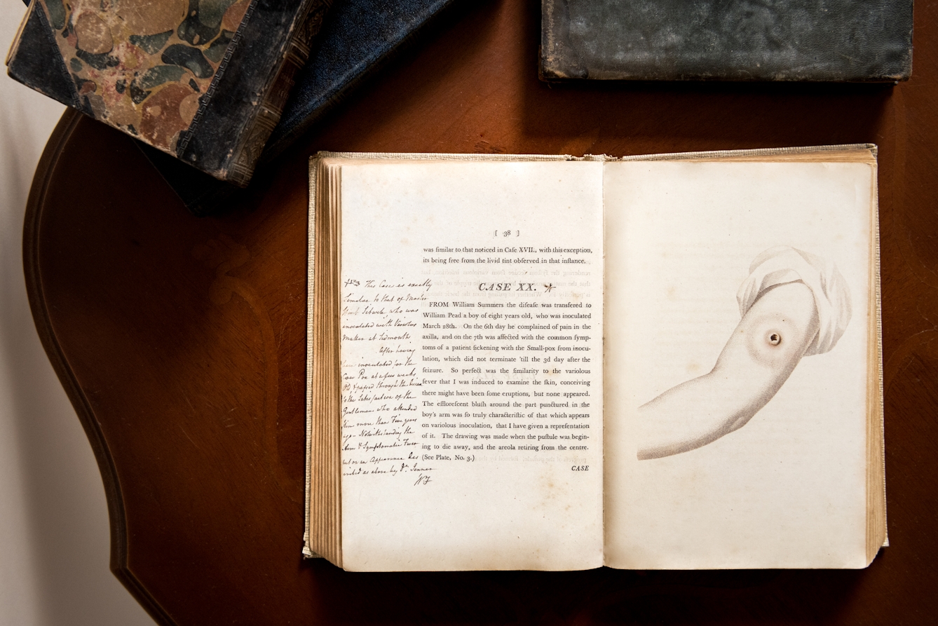 Photograph of an open early printed book resting on a wooden desk. The open double page spread shows printed text on the left hand page, with hand written annotation. The right hand page shows an illustration of an arm with a large crater mark on the bicep. Around the open book can be seen other old books and the ornate edge of the tabletop.