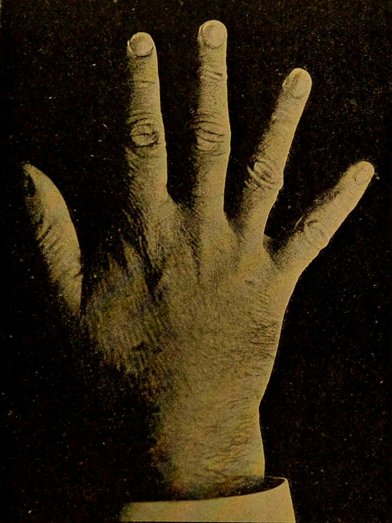 Black and white photo of Emile Zola’s hand.