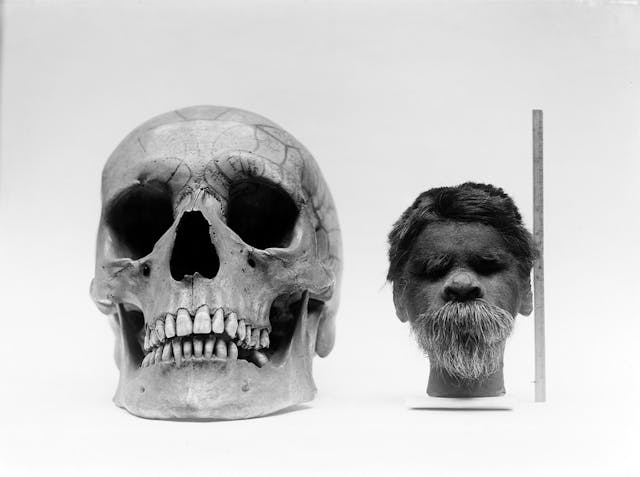 Photo of shrunken head compared with normal human skull
