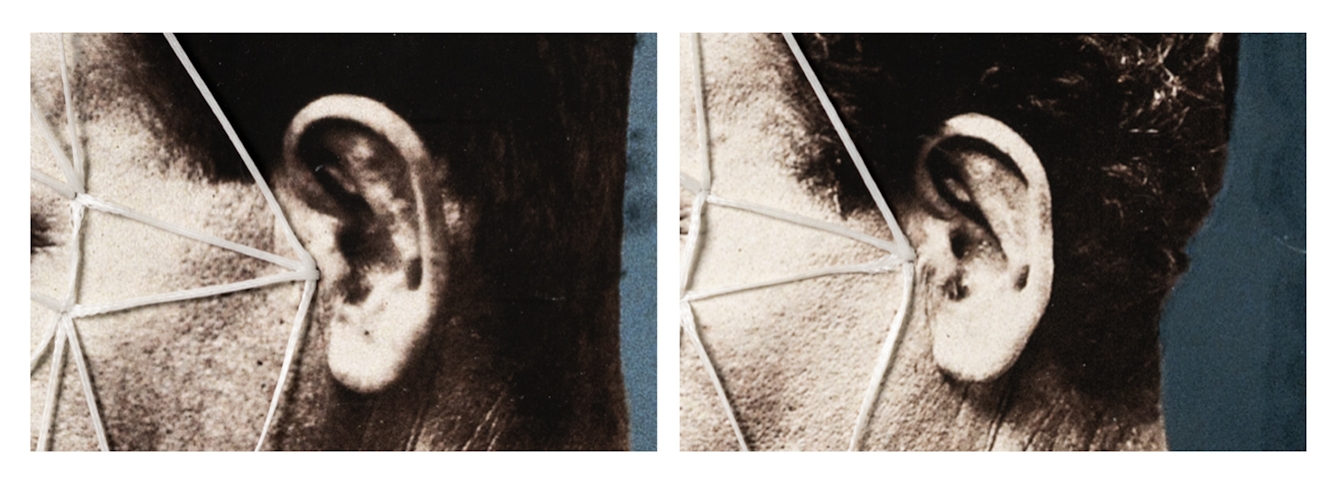 An image of close ups crops of two photographs of a man in profile showing the man's ears and back of the head pre and post plastic surgery. The photographs have been altered with thread so that a series of triangles mimic his facial features with vector like patterns.