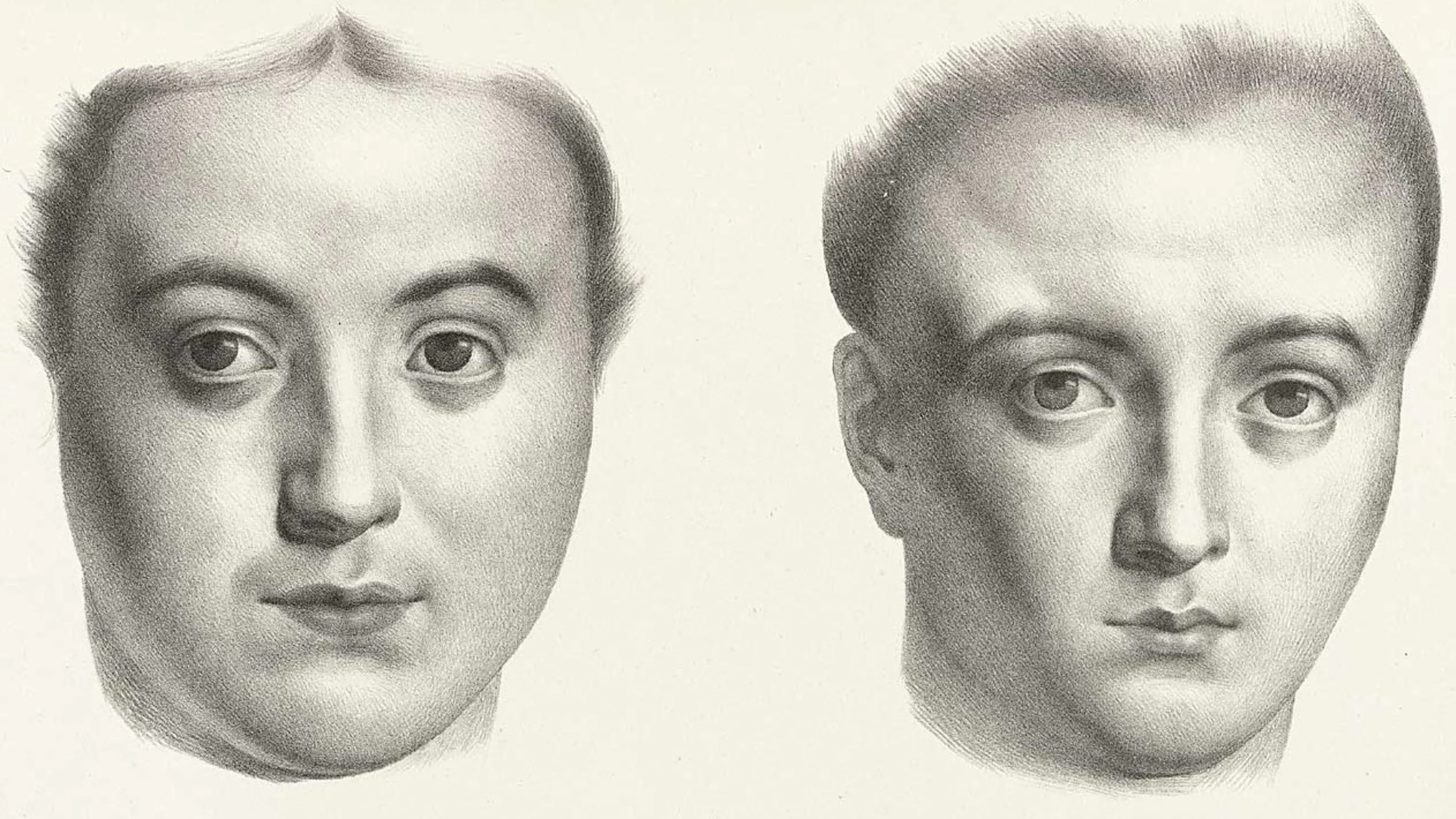 Exceptional talent and the trouble with IQ tests | Wellcome Collection