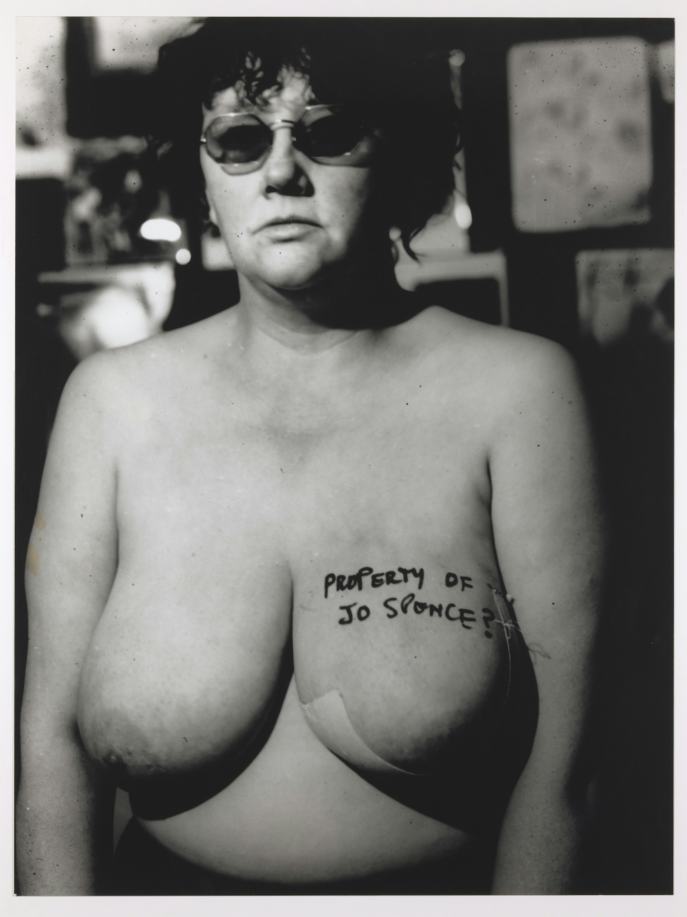 Self-portrait of Jo Spence, naked, with a dressing and 'Property of Jo Spence?' written in black marker on her left breast