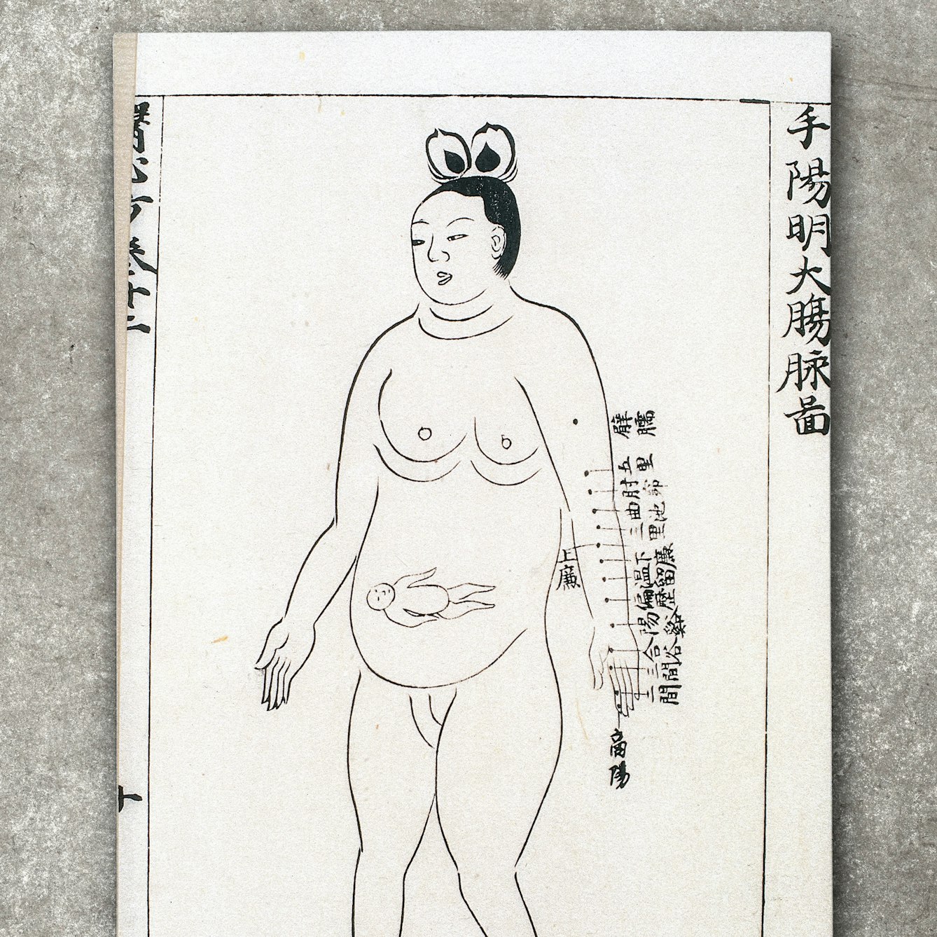 Photograph of a chart showing locations on the large Intestine channel of arm yangming where acupuncture is prohibited during the eighth month of pregnancy, from Ishinpo [Chinese: Yi xin fang] (Remedies at the Heart of Medicine), by the Japanese author Yasuyori Tanba. The chart is resting on a concrete textured background.