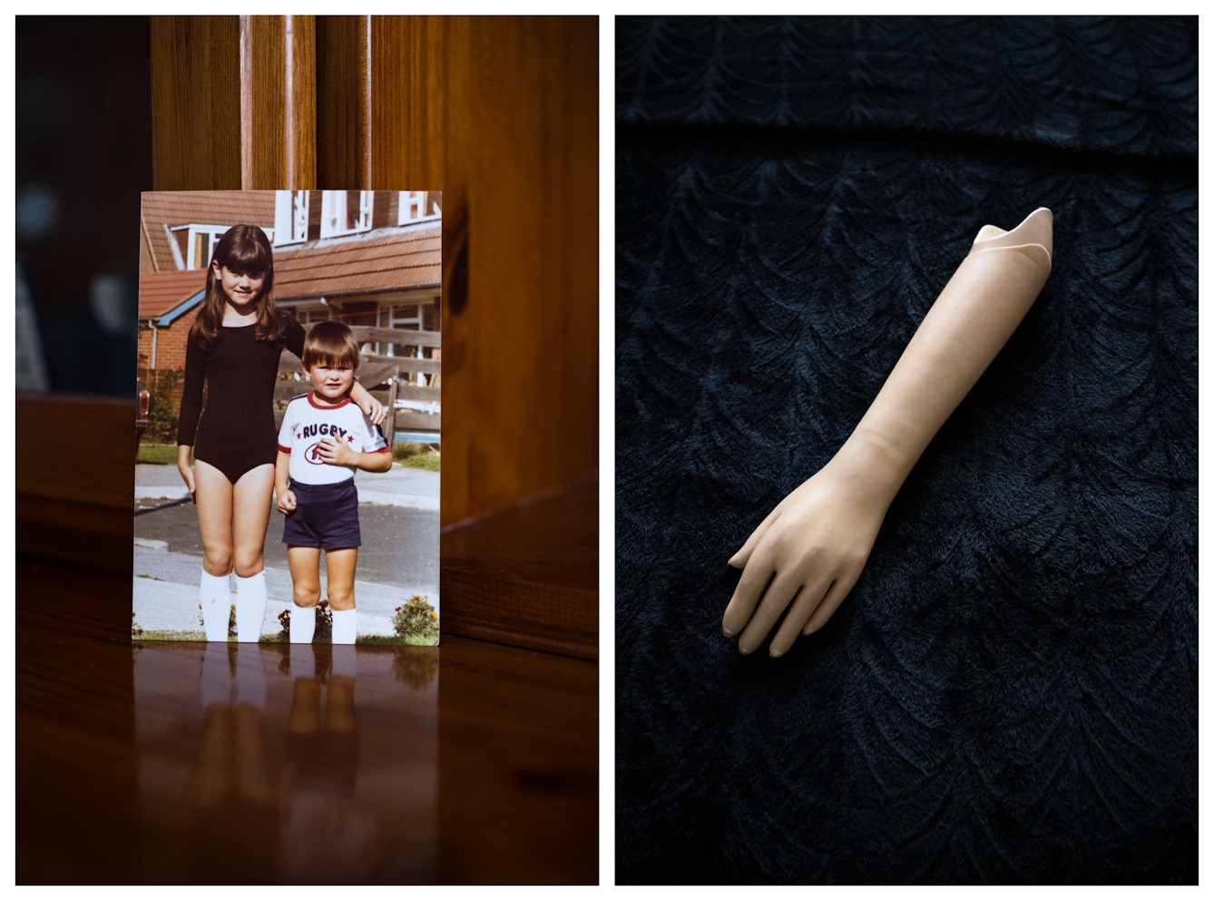 Photographic Diptych. The image on the left shows a family photo propped up on a wood shelf. In the photo is a girl next to a younger boy. The has a prosthetic left arm which she is resting on the boy's shoulder. The image on the right shows the prosthetic arm resting on a dark blue embroidered bed spread.