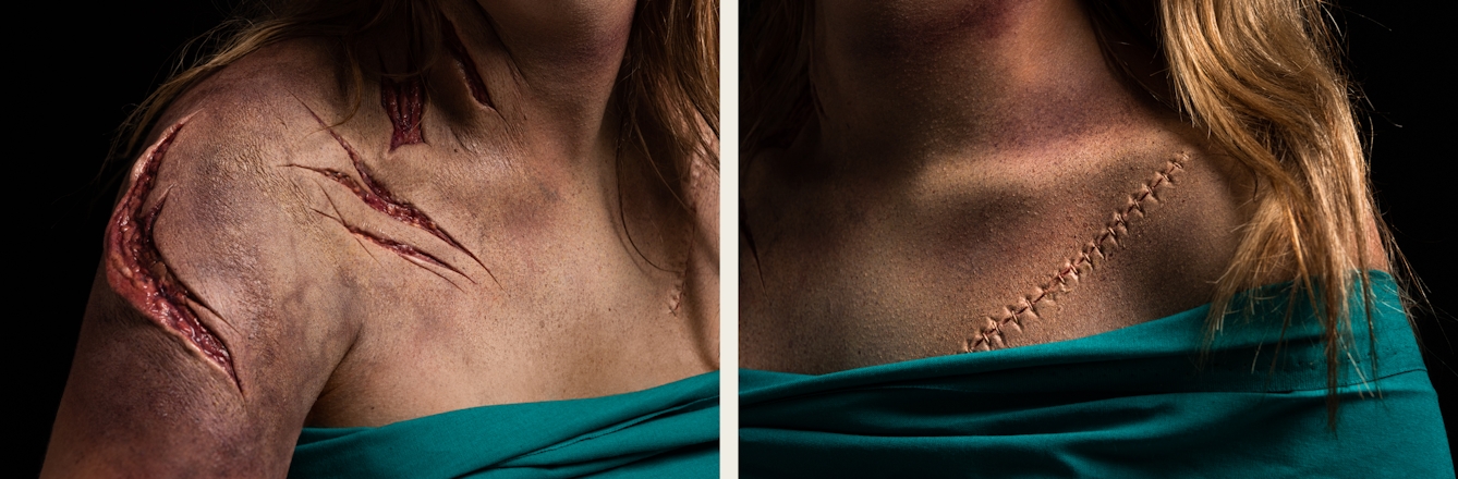 Photographic diptych. The image on the left shows the right shoulder and chest of a woman. Her chest is covered with a green surgical sheet. She has prosthetic makeup applied which creates the realistic effect of her neck and shoulders having been slashed with a knife. The makeup reveals the layers below the skin. The image on the right shows the left shoulder and chest of the same woman, with her chest again covered with a green surgical sheet. She has prosthetic makeup applied which creates the impression of a long surgical cut which has been stitched up.