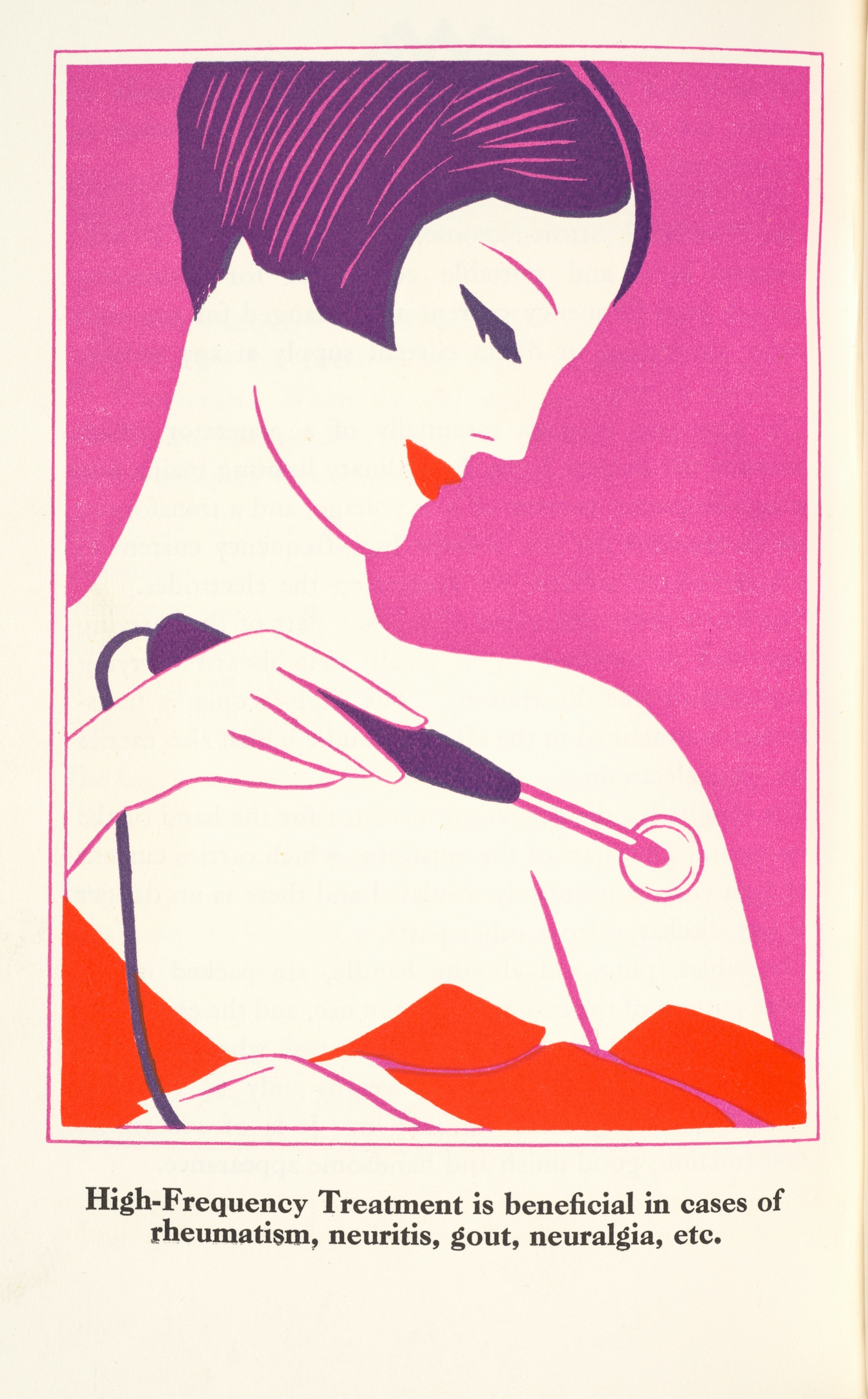 Photograph of a page from an illustrated booklet. The illustration in red, purple and violet shows the head and shoulders of a woman holding a wired handheld device against her upper arm. The image is captioned, 'High-frequency Treatment is beneficial inc cases of rheumatism, neuritis, gout, neuralgia,etc.'