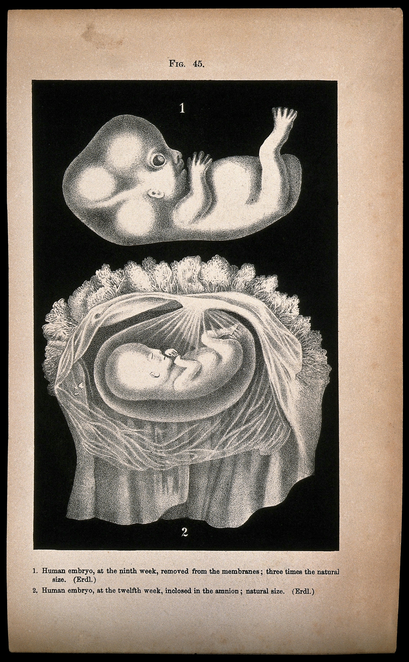 Human embryo, two figures: above, the foetus at nine weeks, below, the foetus at twelve weeks, shown enclosed in the amnion. Lithograph after Erdl, 1850/1900?