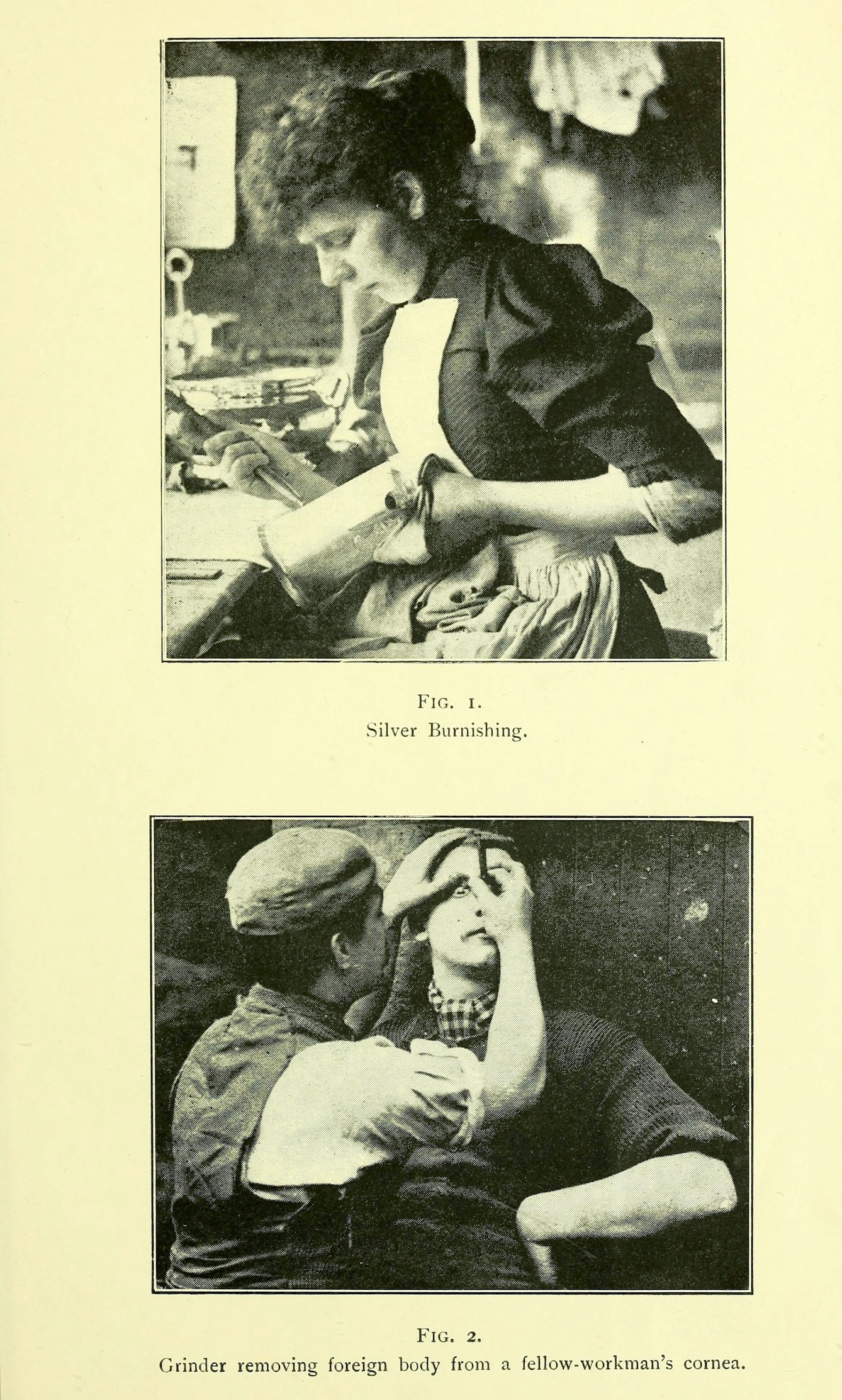 Two grainy black and white photographs on a page. The top one, labelled "silver burnishing" is a woman wearing an apron holding a silver vessel in one hand and a tool in the other. The bottom one is of two men in working clothes. One is removing a "foreign body from a fellow-workman's cornea".