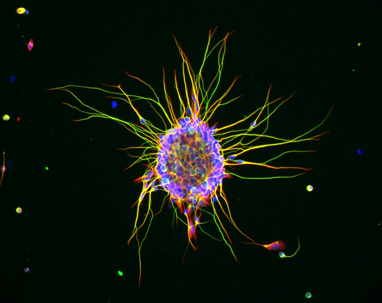 This fluorescence microscopy image shows a cluster of a special type of nerve cells, called cerebellar granule cells, growing in culture. These cells naturally gather together. When placed in a culture dish covered in a particular protein, they start sending out long projections (yellow/green) as they would in the developing brain. 