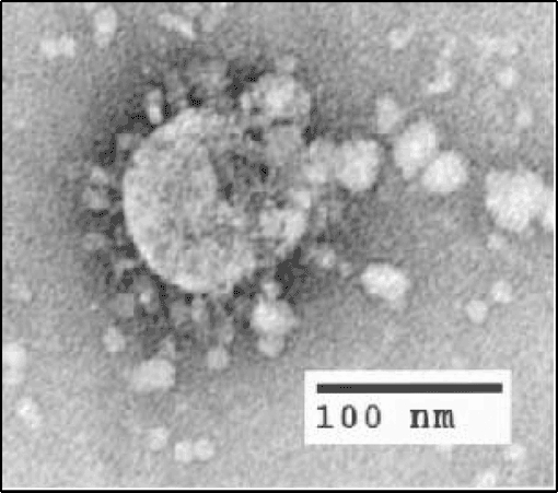 Black and white microscopic image of SARS virus. 