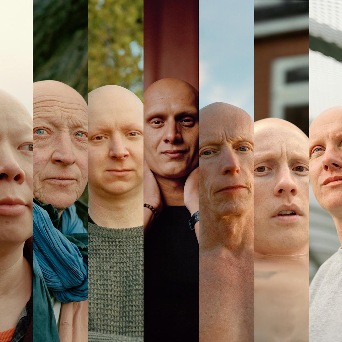 Photographic composite image of 11 portraits featuring men with alopecia universalis.