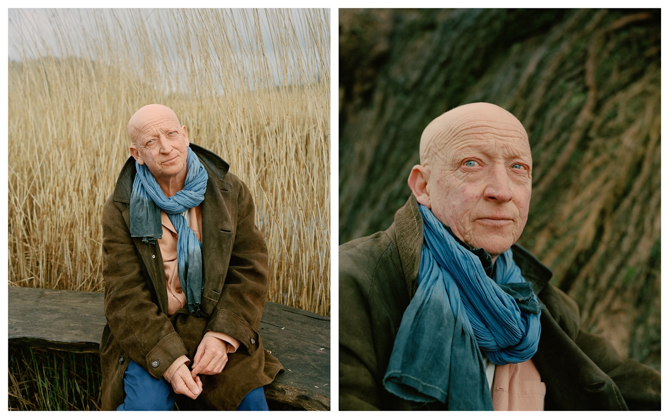 Photographic portrait of a man with alopecia universalis presented as a diptych. The image on the left shows the man seated on a wooden ledge surround by long grass and reeds. He is looking to camera, head slightly tilted. The image on the right shows the man closer up as he gazes into the distance.