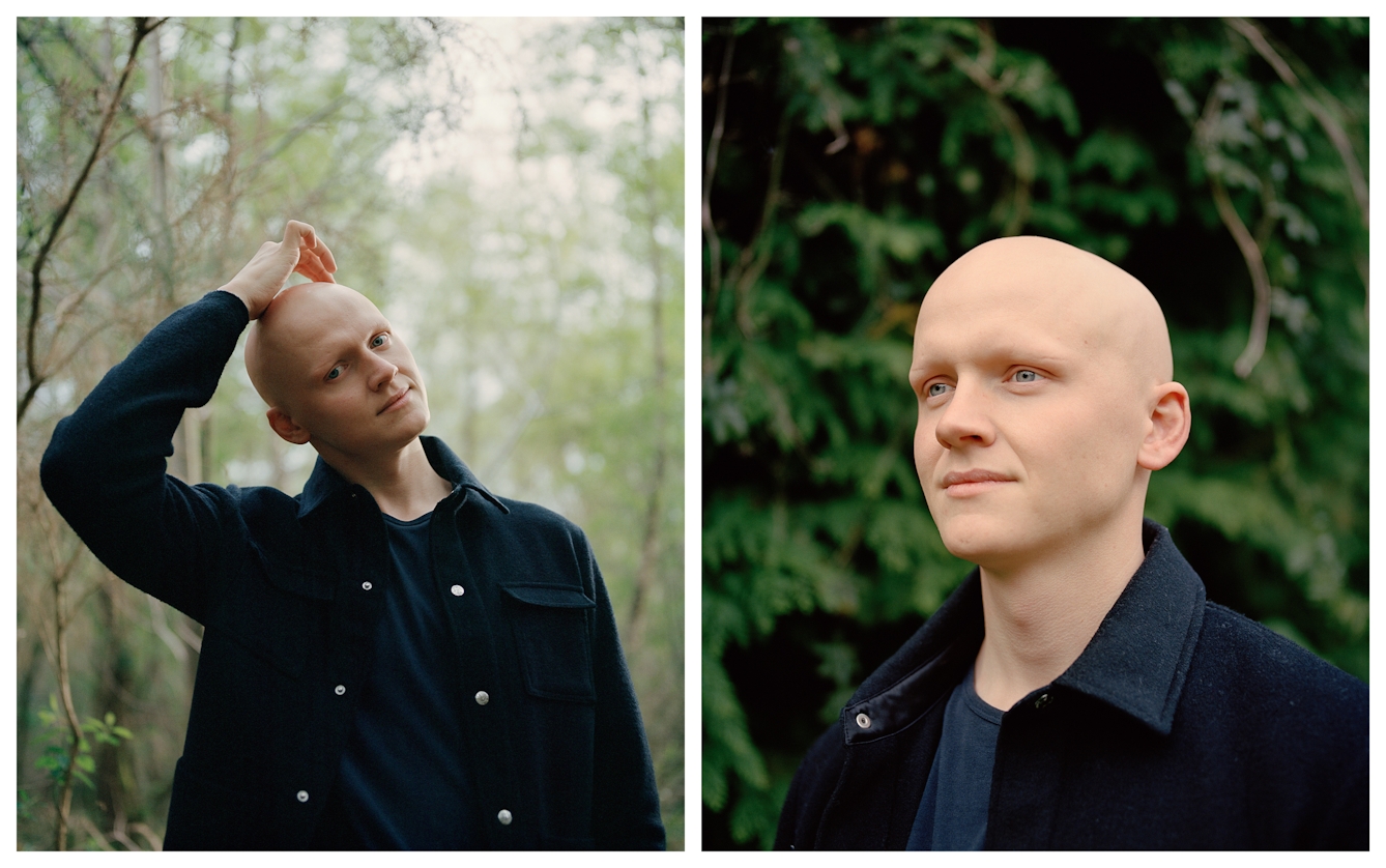 Photographic portrait of a man with alopecia universalis presented as a diptych. The image on the left shows the man in a woodland scene looking straight to camera, one hand touching his head. The image on the right show a closer up view of the man's head and shoulders as he gazes off to the left.