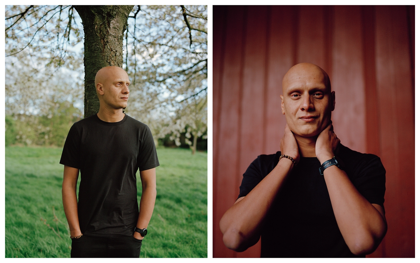 Photographic portrait of a man with alopecia universalis presented as a diptych. The image on the left shows the man standing in front of a tree trunk in a park land scene, looking off to the right. The image on the right shows the man indoors, in front of red translucent curtains looking straight to camera.