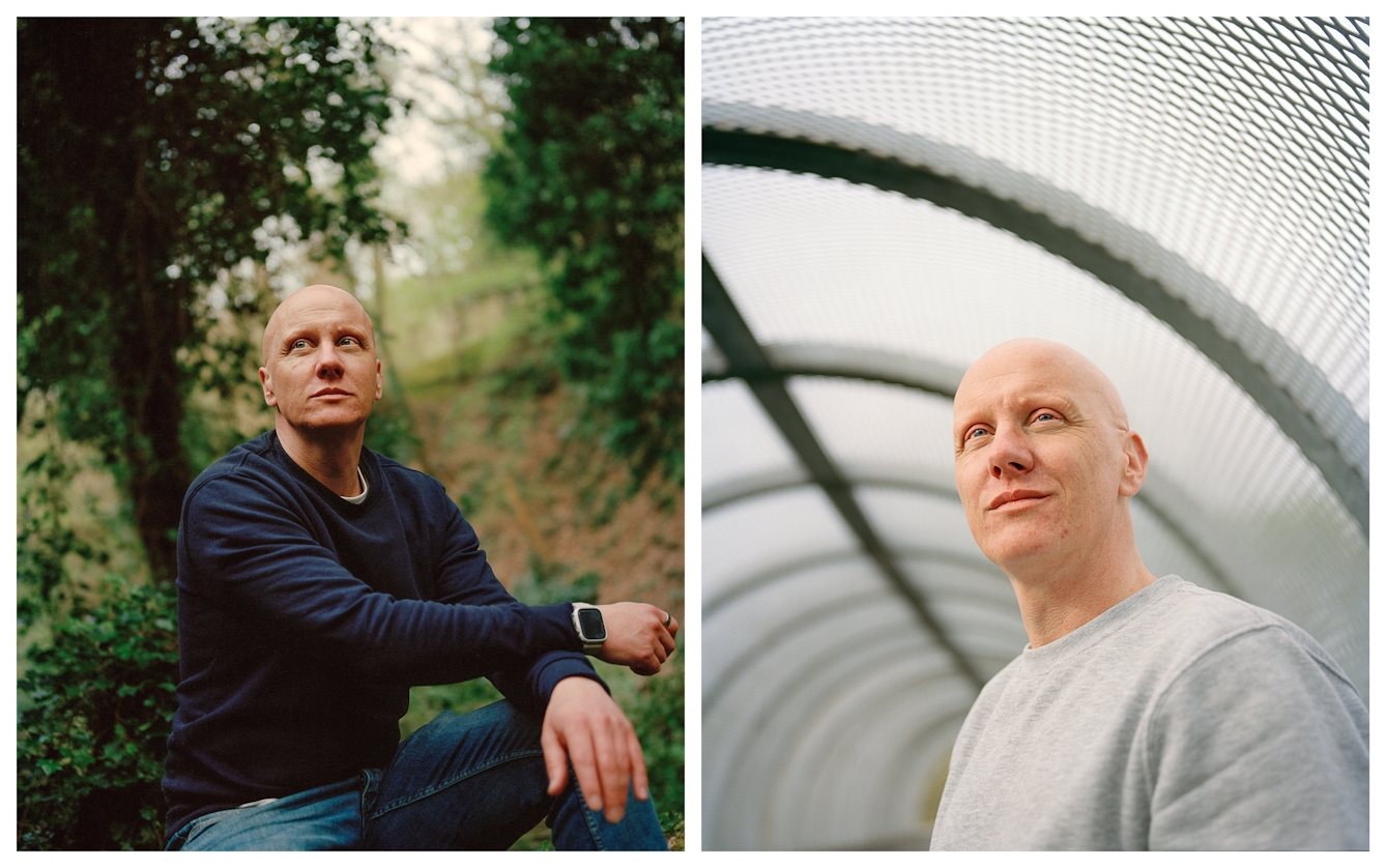 Photographic portrait of a man with alopecia universalis presented as a diptych. The image on the left shows the man in a woodland scene looking off to the left. The image on the right shows the man closer up this time in a metal mesh tunnel, again looking off to camera left.