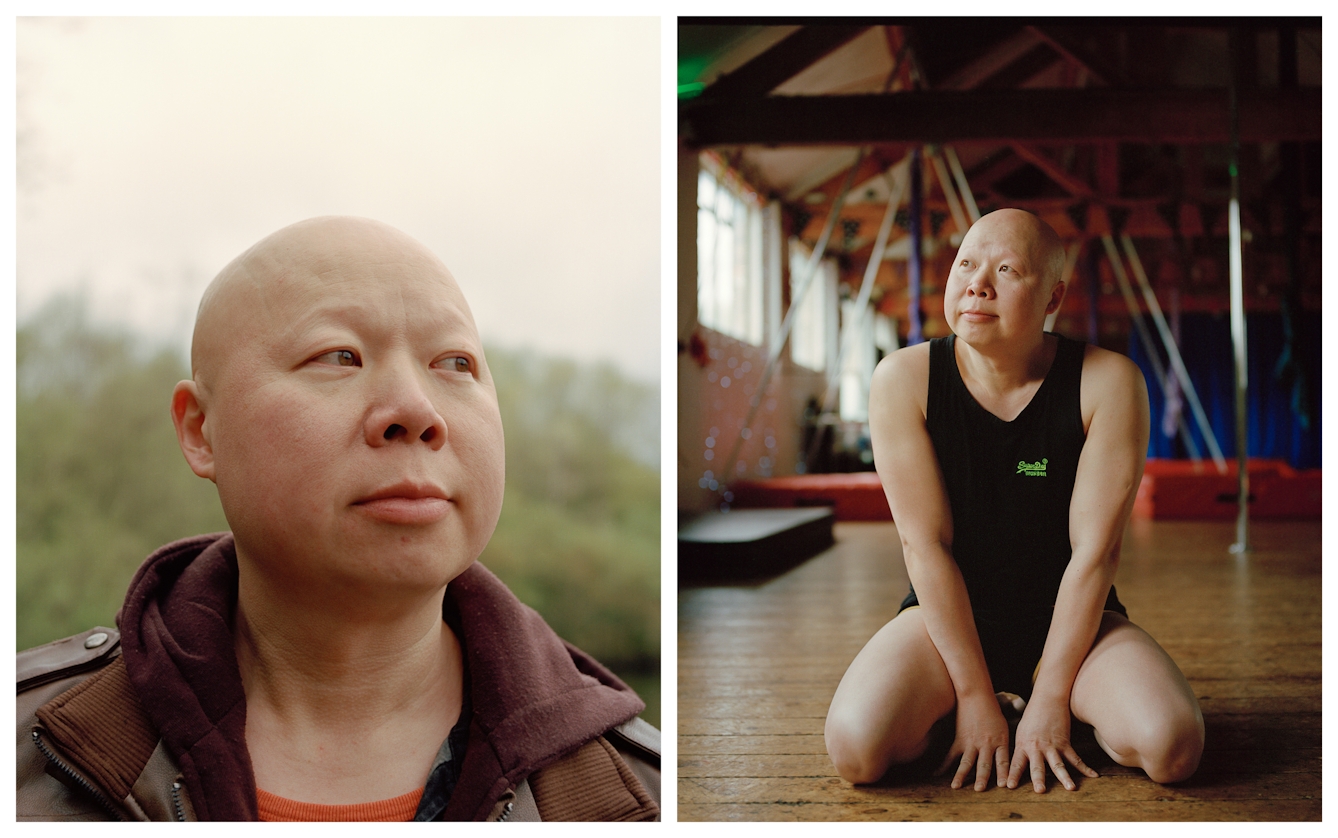 Photographic portrait of a man with alopecia universalis presented as a diptych. The image on the left shows the man in a parkland from the chest up, gazing off to the right. The image on the right show the man squatting in a gym scene looking off to the left.